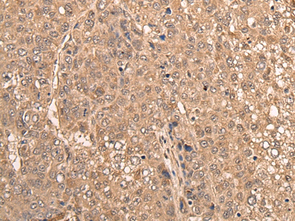 WDFY3 Antibody