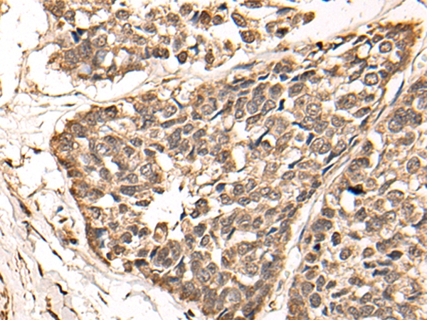 WDFY3 Antibody