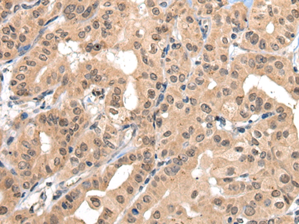 ZBTB44 Antibody