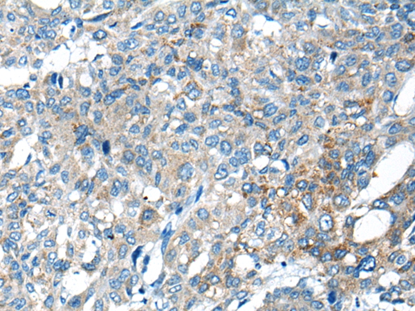 ZC2HC1A Antibody