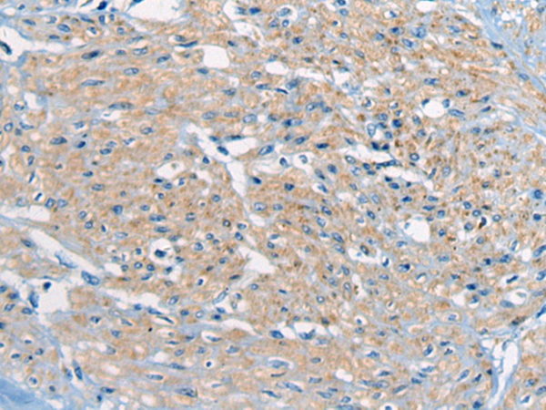 ZC2HC1A Antibody