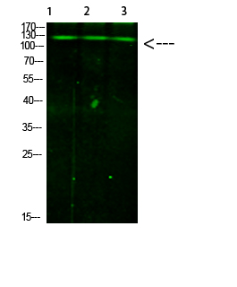 JAK2/3 (Phospho-Tyr966/939) Antibody