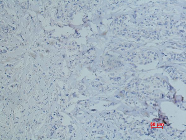 CD10 Monoclonal Antibody(5B8)