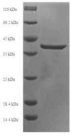 Recombinant Human Probable DNA dC->dU-editing enzyme APOBEC-3A(APOBEC3A)