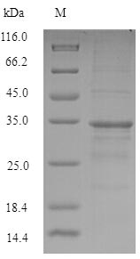 Recombinant Mouse Major urinary protein 6(Mup6)