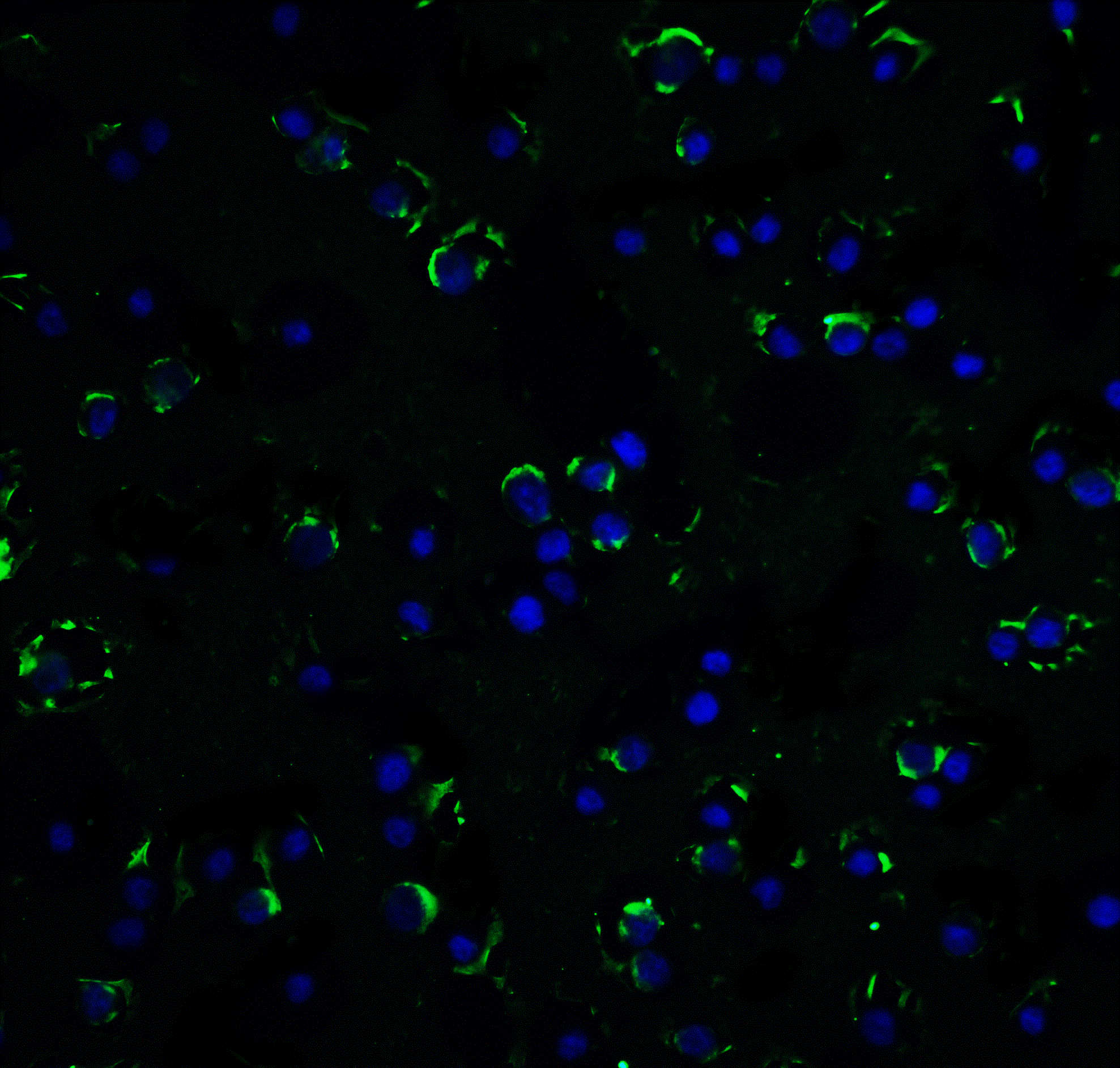 RAIDD Antibody