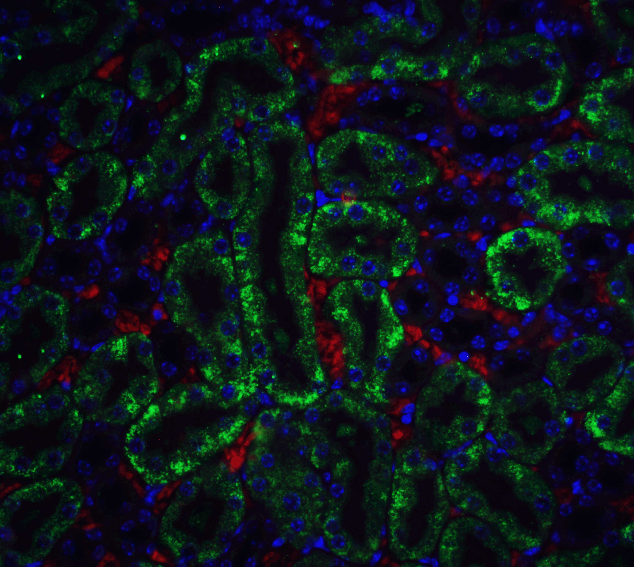 CAD Antibody