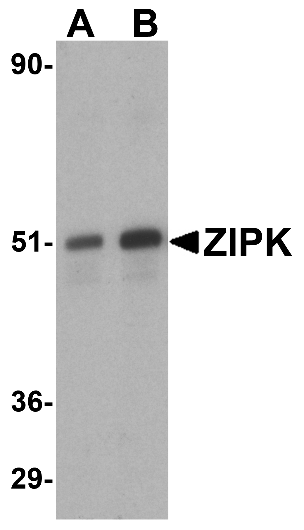 ZIPK Antibody