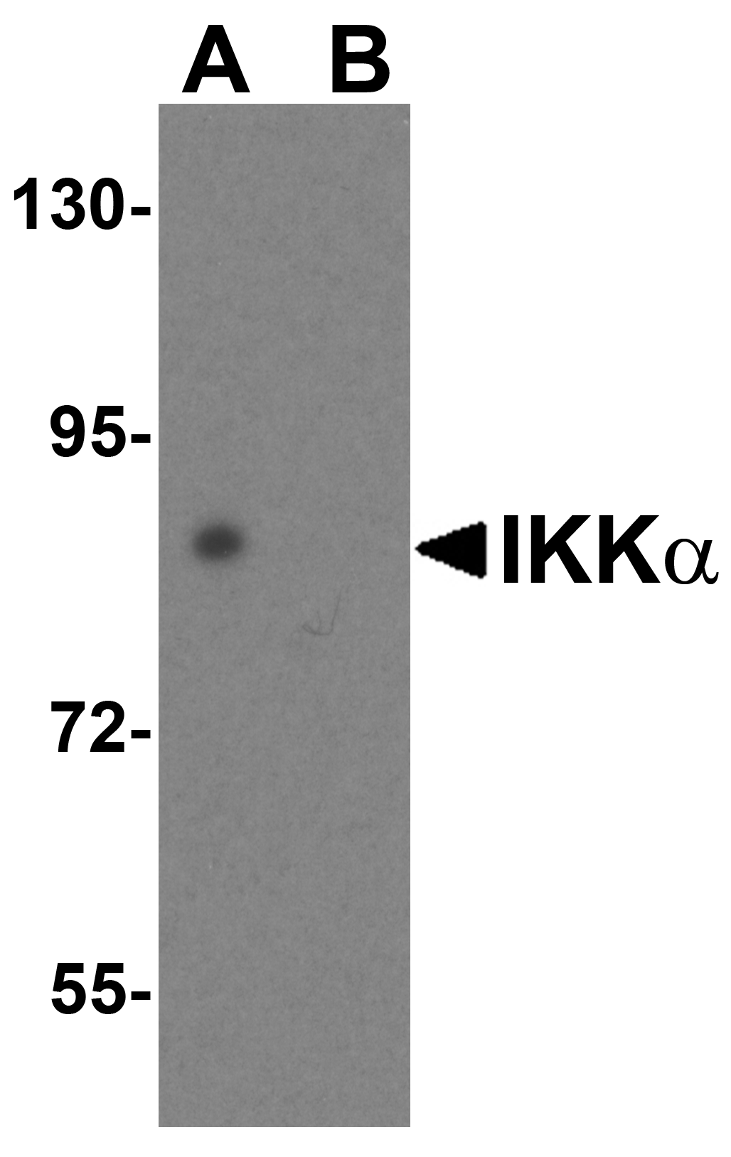 IKK alpha Antibody