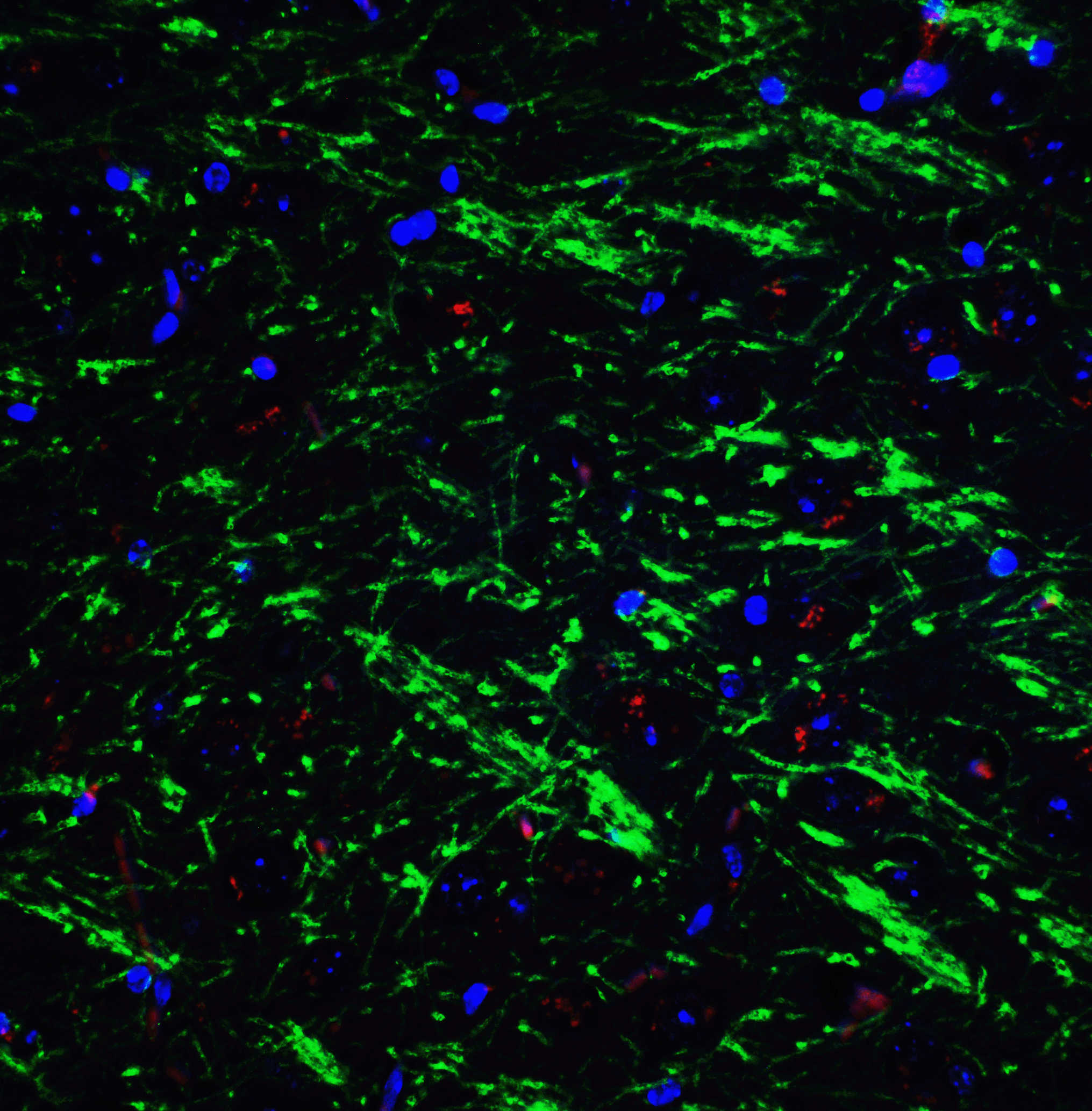 BAG-1 Antibody