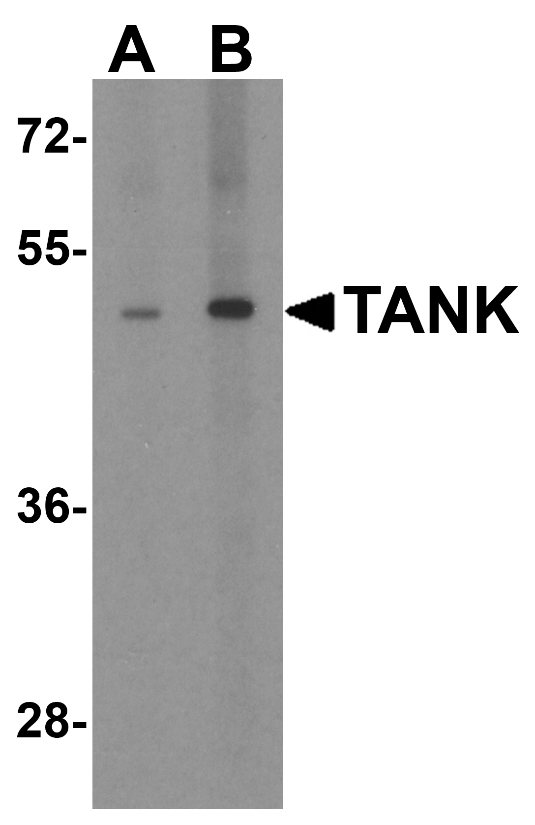 TANK Antibody