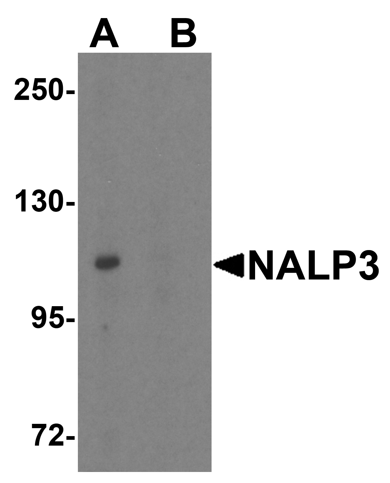 NALP3 Antibody