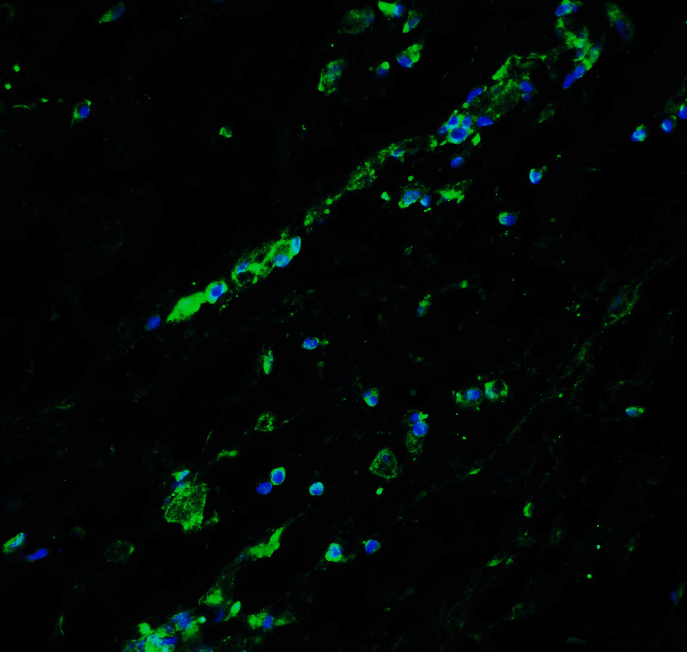 Bcl9L Antibody