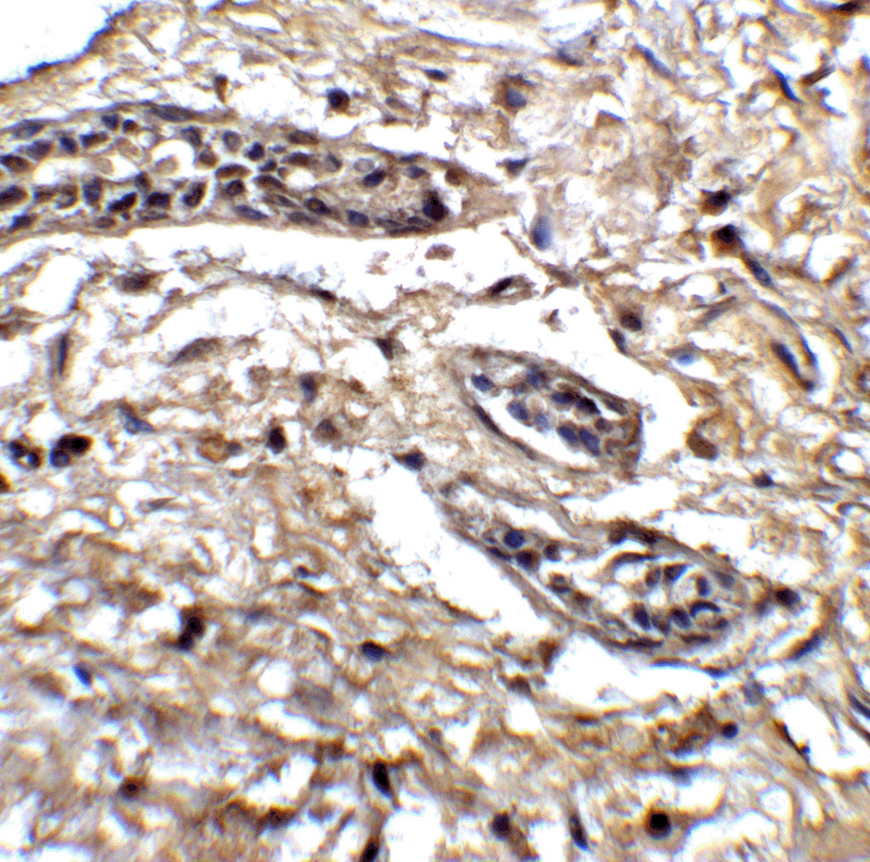 Bcl9L Antibody