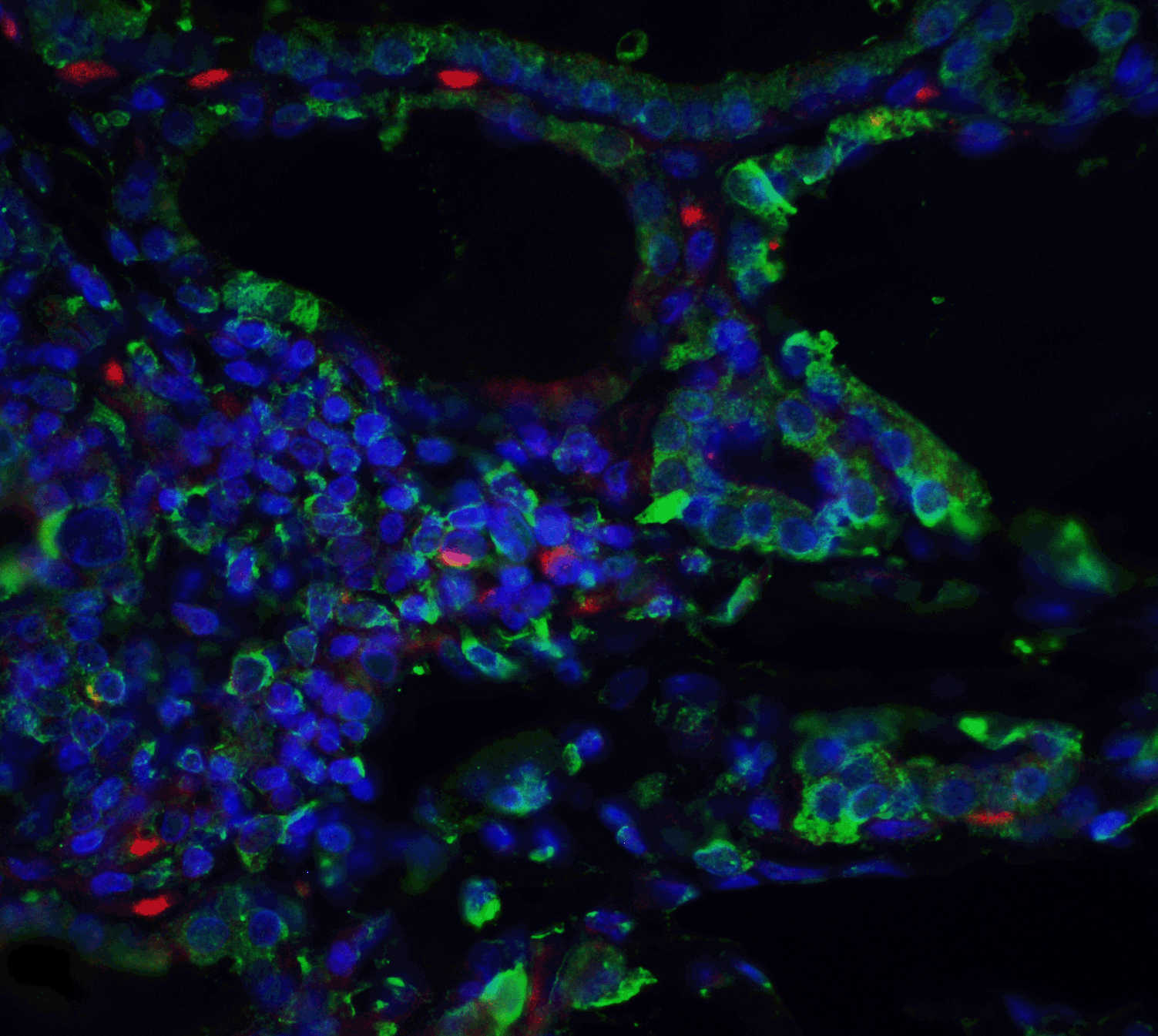 ORAI3 Monoclonal Antibody