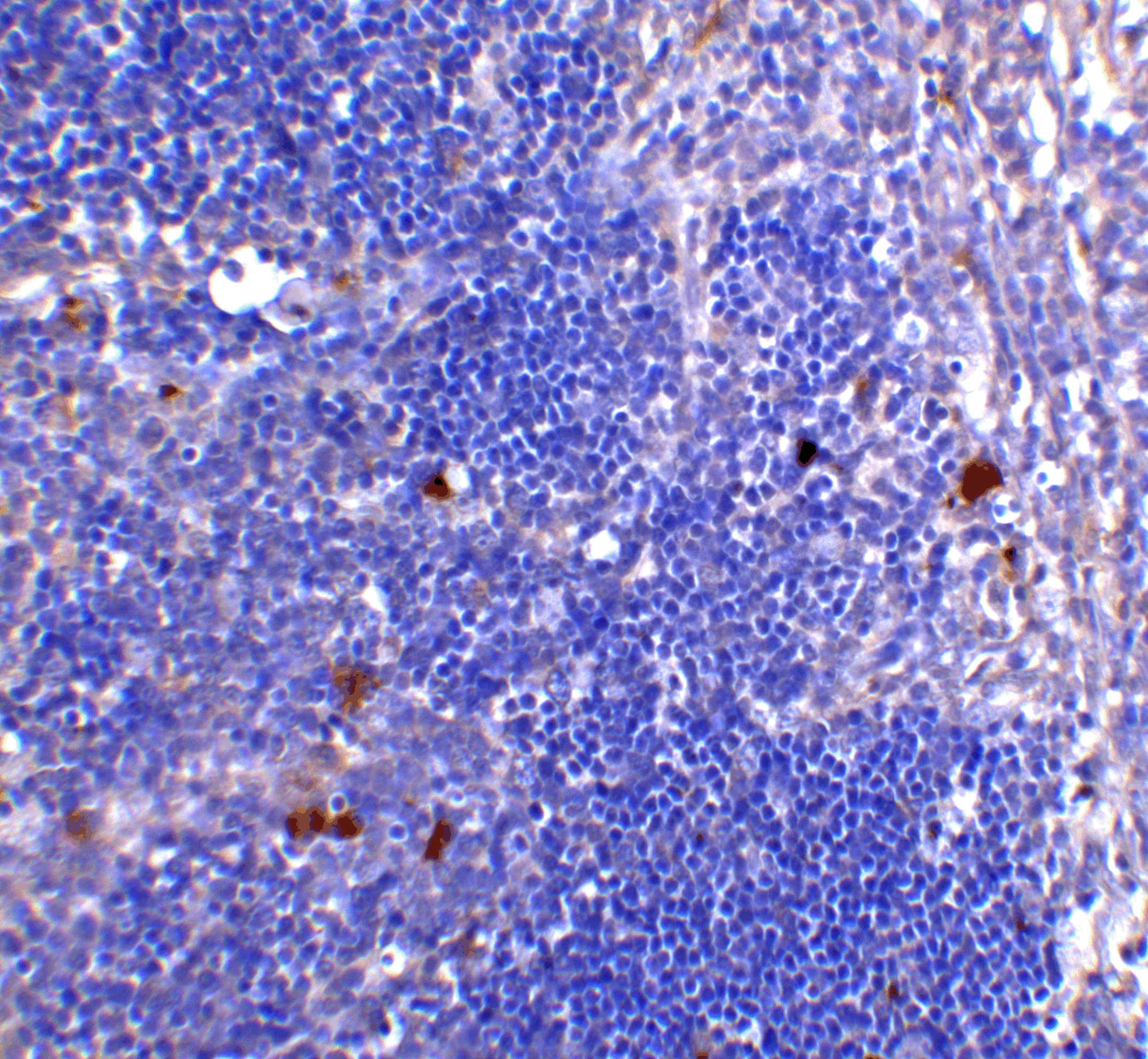 CD4 Monoclonal Antibody