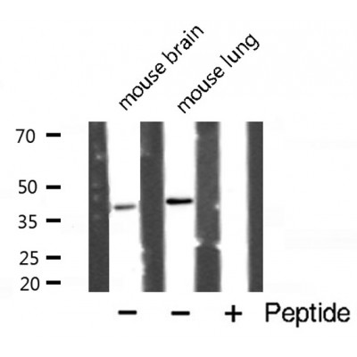 caspase-4 antibody