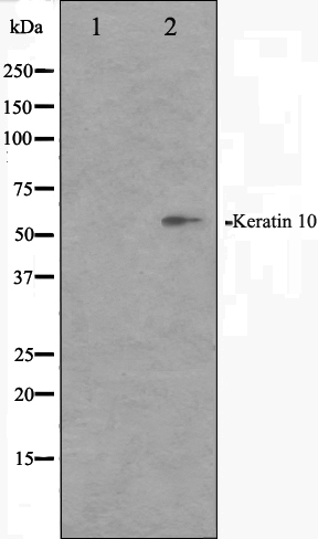 pan-Cytokeratin antibody