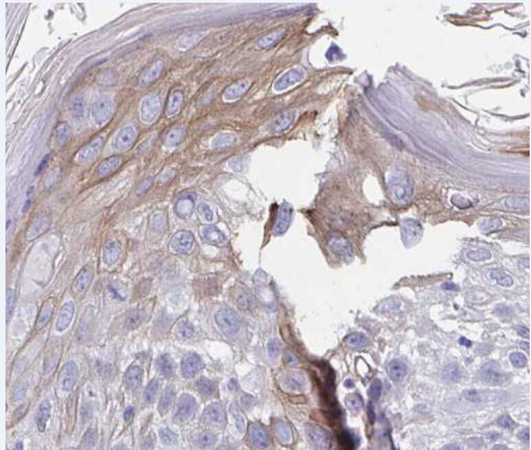 pan-Cytokeratin antibody