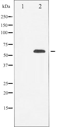 beta Tubulin 3 antibody