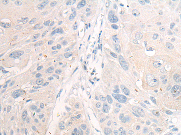 ACD Antibody