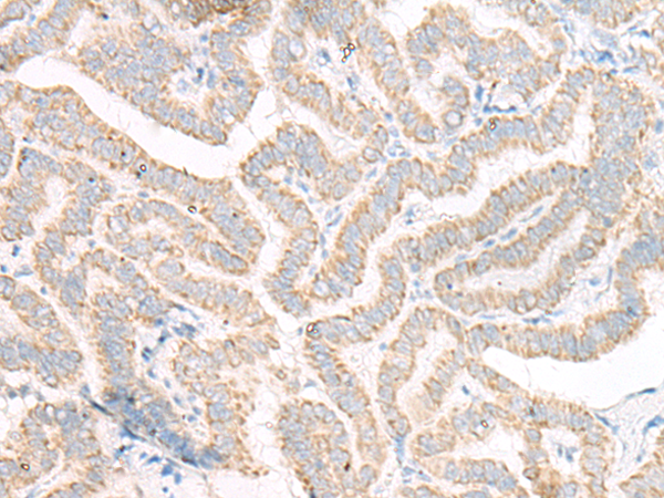 ACSF2 Antibody