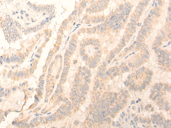 ADGRE3 Antibody