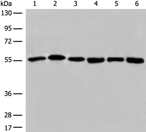 ALDH7A1 Antibody