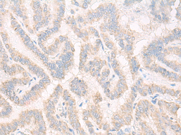 BPIFB1 Antibody