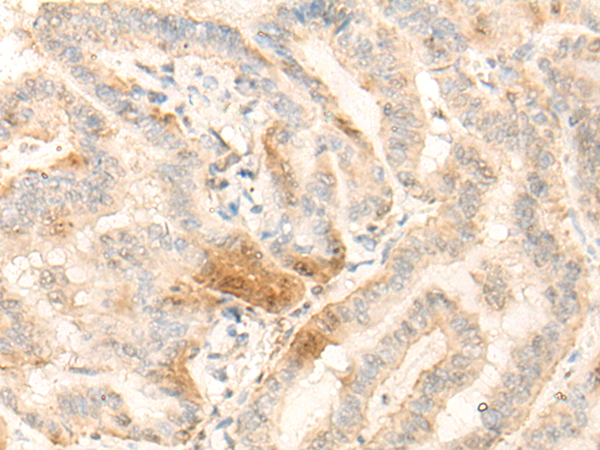 BZW2 Antibody