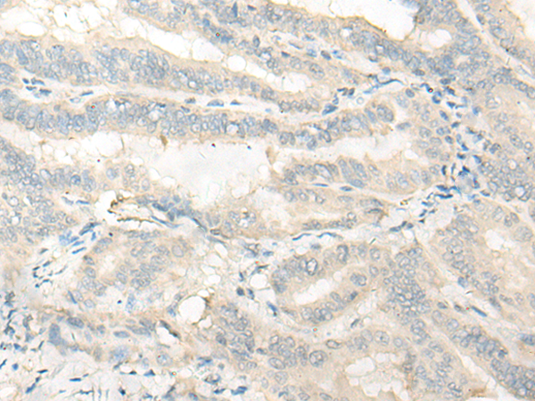 C11orf49 Antibody