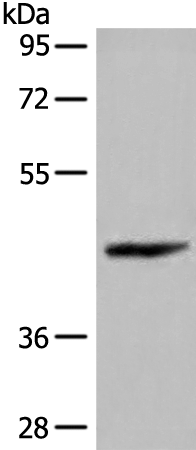 C11orf49 Antibody