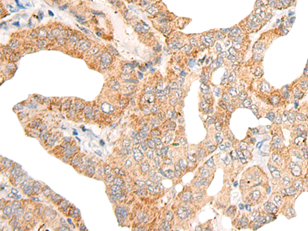 CALCOCO1 Antibody