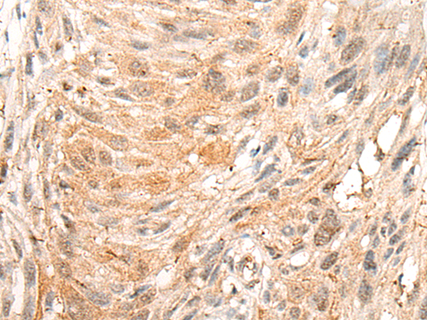 CALCOCO1 Antibody