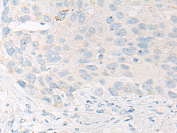 CCP110 Antibody