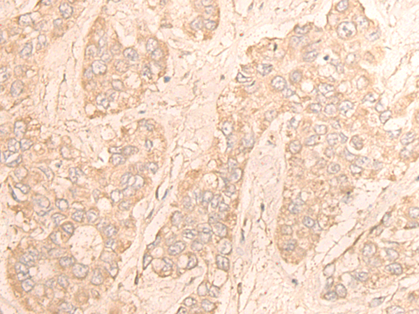 CDK18 Antibody