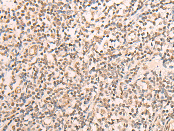 CELF2 Antibody