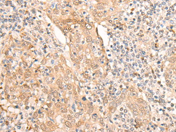 CELF2 Antibody