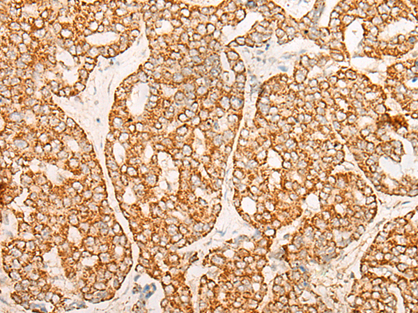 CHAC2 Antibody