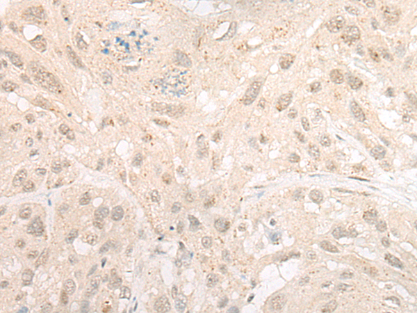 CHERP Antibody