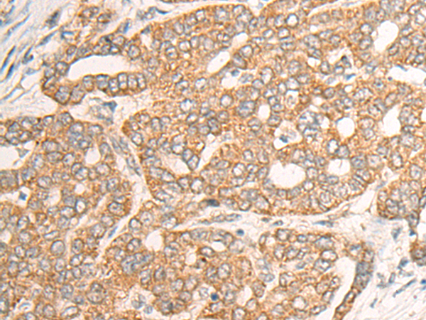 CHI3L2 Antibody