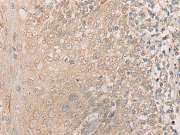 CHI3L2 Antibody