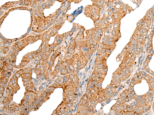 CHKB-CPT1B Antibody