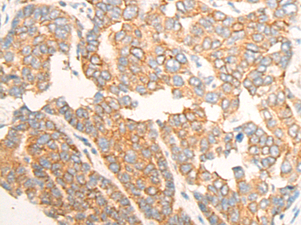 CLEC12A Antibody