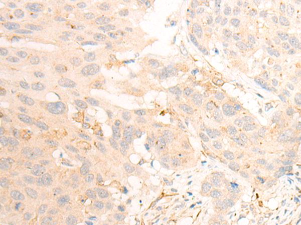 CLEC12A Antibody