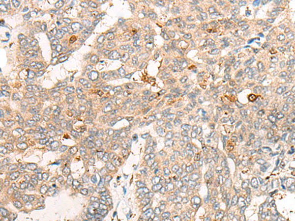 CNDP2 Antibody