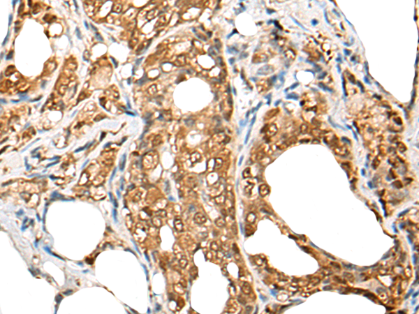 CNDP2 Antibody