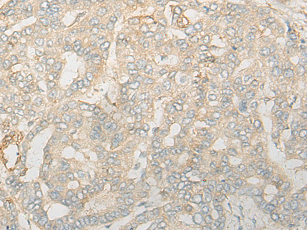 CNOT6 Antibody