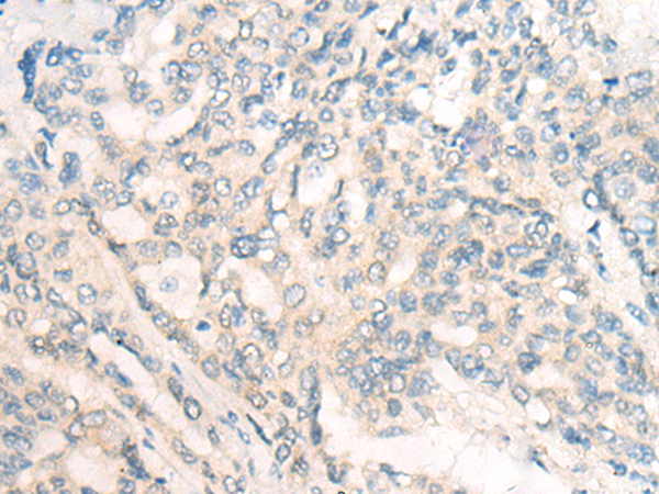 CNR1 Antibody