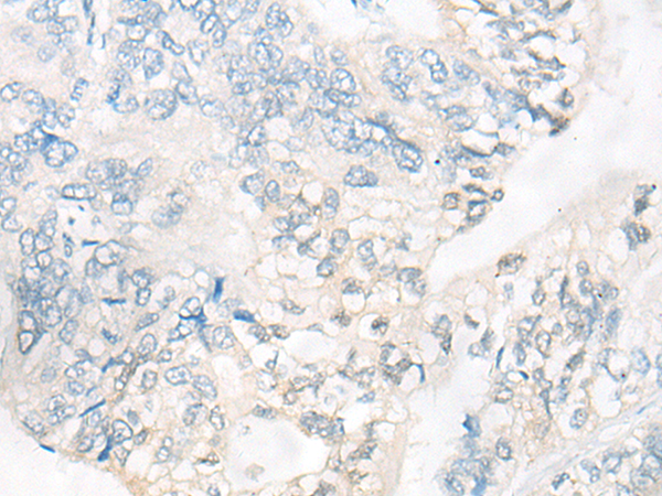 CNR1 Antibody